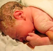 Vernix Caseosa: Wash It Off Baby After Birth or Rub It In?