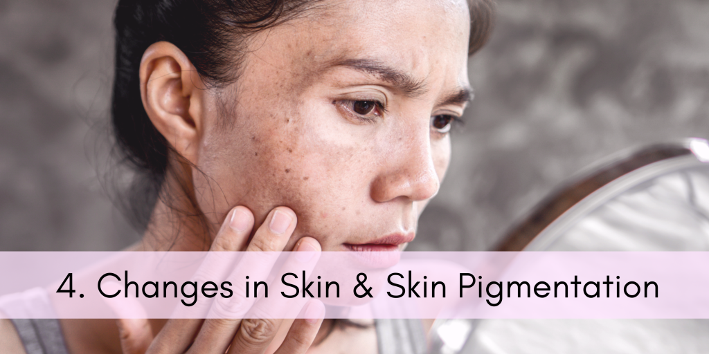 Strange Changes During Pregnancy - Changes in skin & Skin Pigmentation